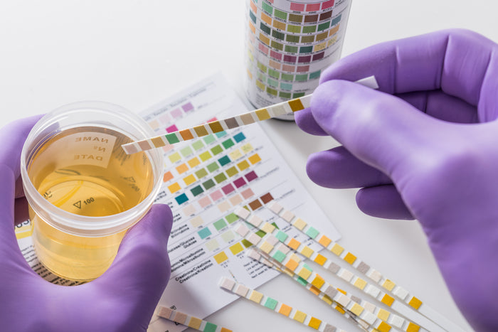5 Things You Didn’t Know About Urine